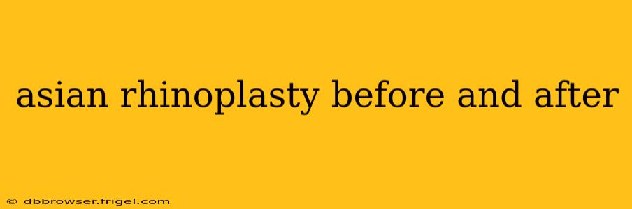 asian rhinoplasty before and after