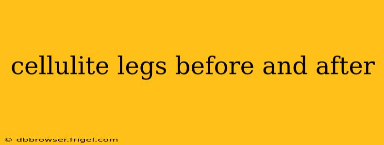 cellulite legs before and after