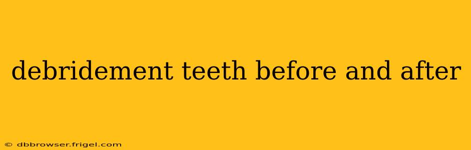 debridement teeth before and after