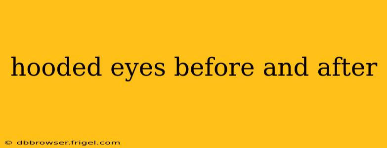 hooded eyes before and after