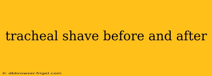 tracheal shave before and after