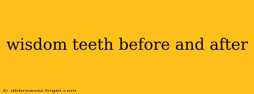 wisdom teeth before and after